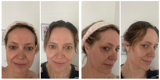 Red Light Therapy for Wrinkles: Before and After Results You Must See