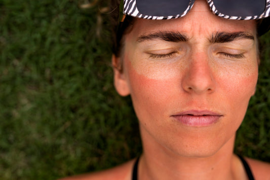 Red Light Therapy for Sun-Damaged Skin: A Practical Guide