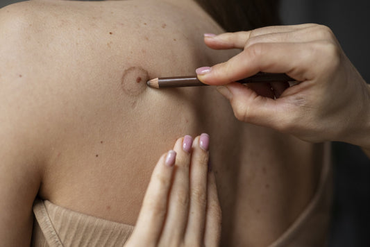 Skin Cancer UK Statistics: What the Data Tells Us